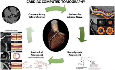 Frontiers | The role of cardiac computed tomography in predicting